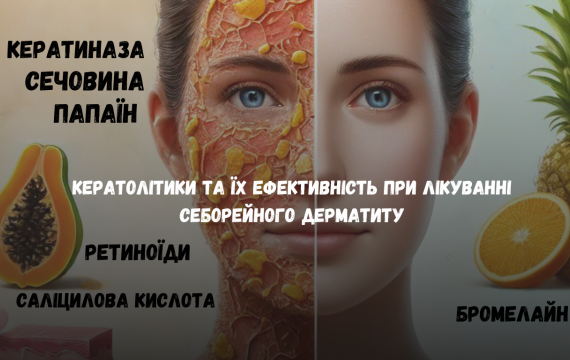 Кератолітики та їх ефективність при лікуванні себорейного дерматиту